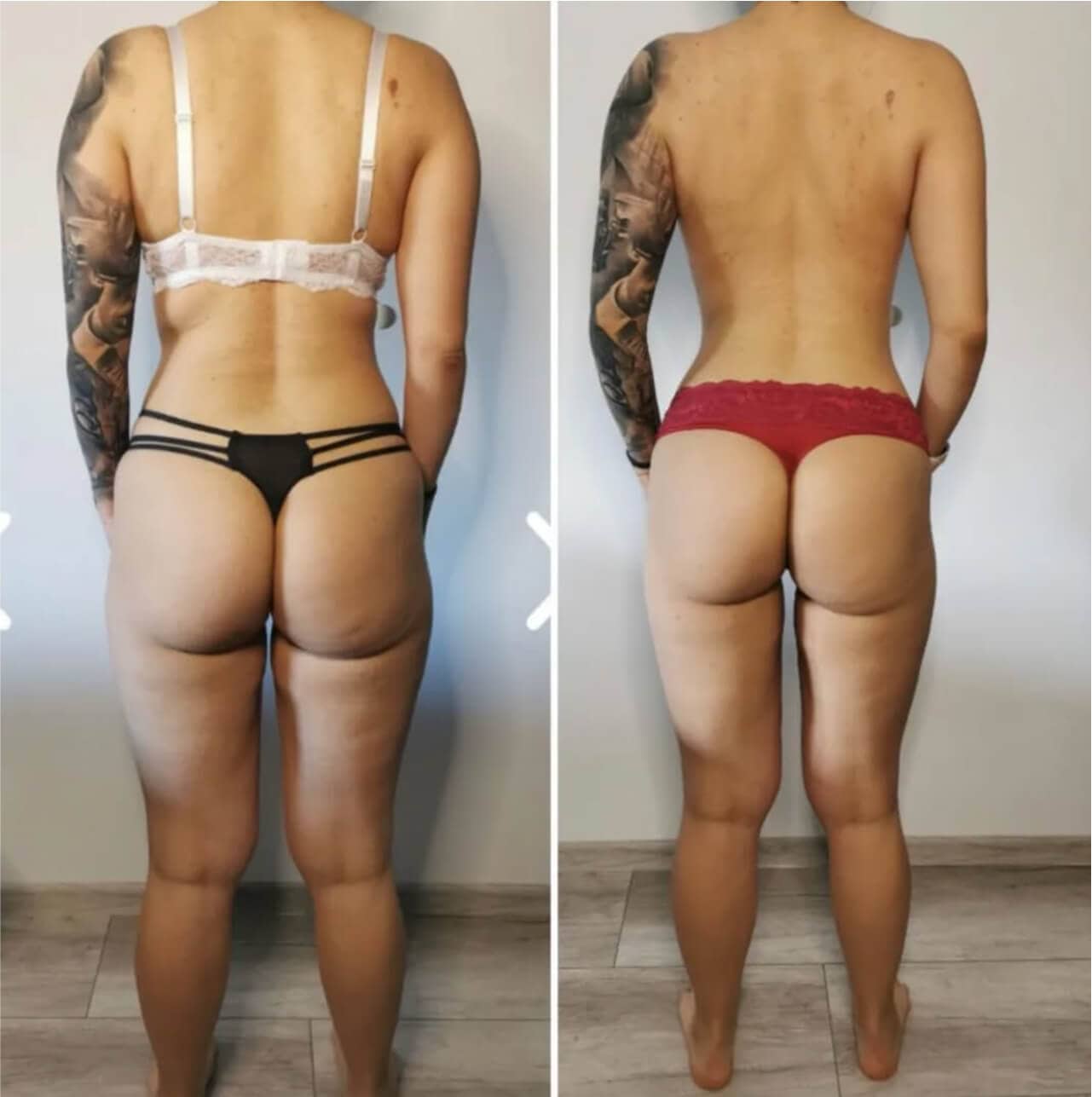 Metamorfoza 3